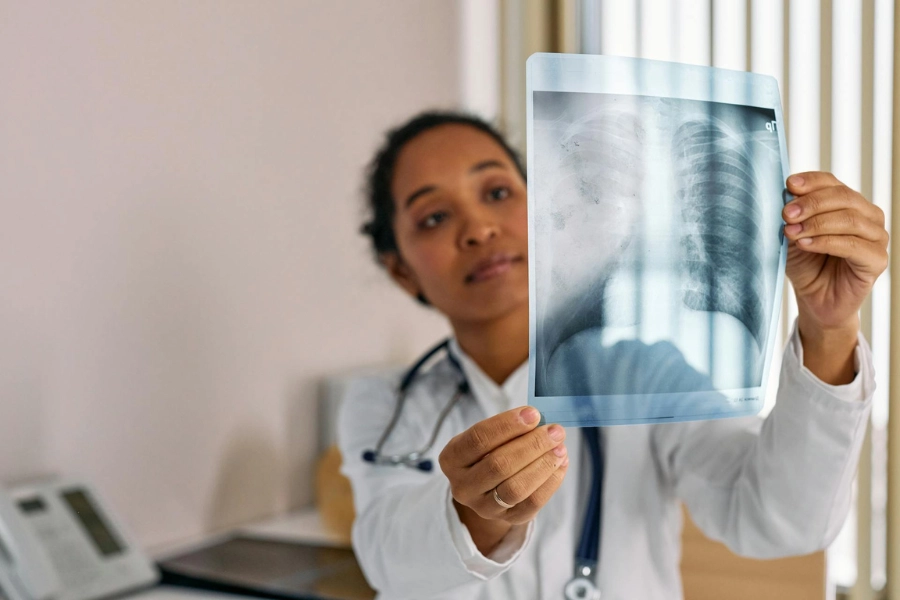 Doctor checking lung x ray for pre existing conditions